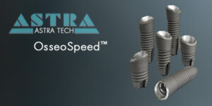 Astra® Osseospeed