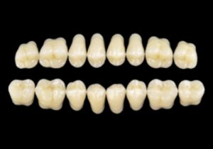 CROSS LINKED 2 Posterior Teeth